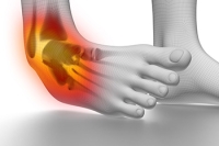 Causes and Risk Factors of Ankle Sprains