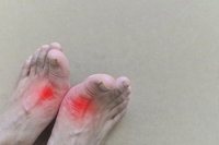 The Agony of Gout and How a Podiatrist Can Help
